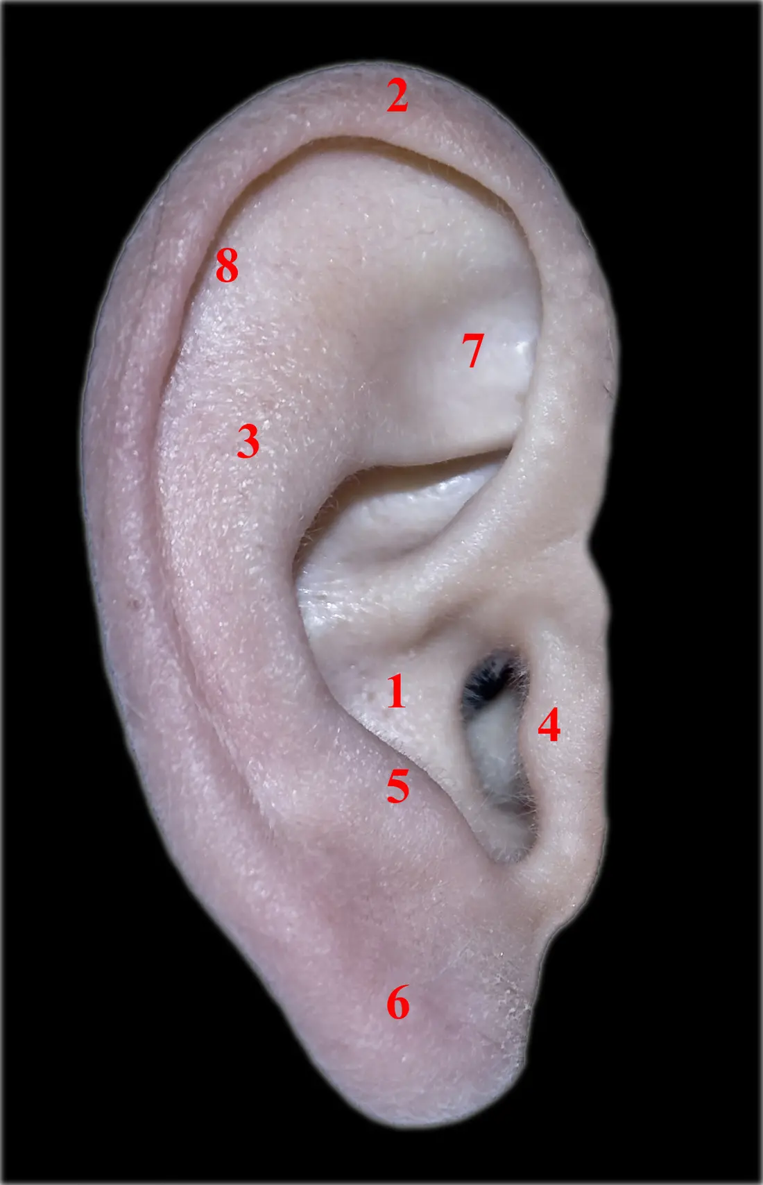 A labelled photograph of the outer ear with the anti-tragus marked 5, the small ridge above the earlobe opposite the tragus