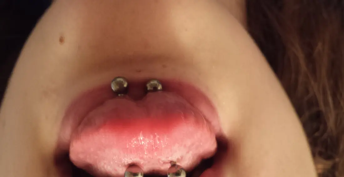 Two healed tongue piercings placed side by side near the tip, each a straight barbell with a bead on top and underneath