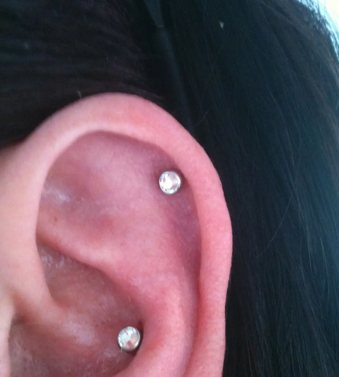 Gem studs in a healed helix and conch