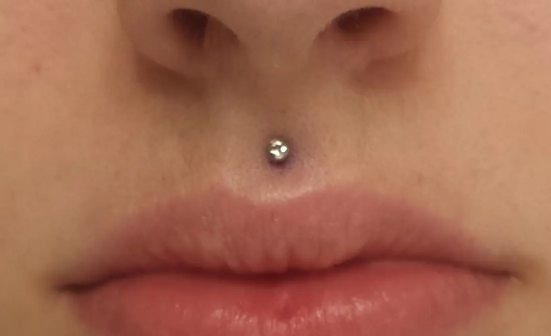A gem stud centred in the philtrum, the groove running from the nose to the upper lip